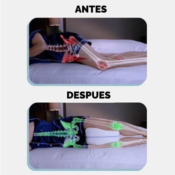 Confort Leg™ Almohada Ortopédica - ENVÍO GRATIS